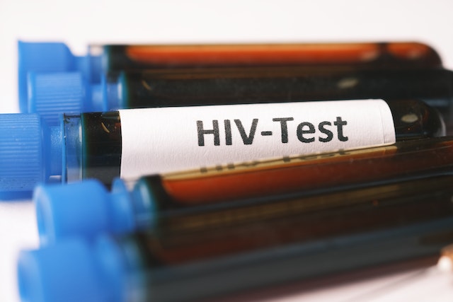test VIH